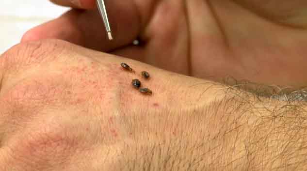 Bed Bug Feeding on Skin